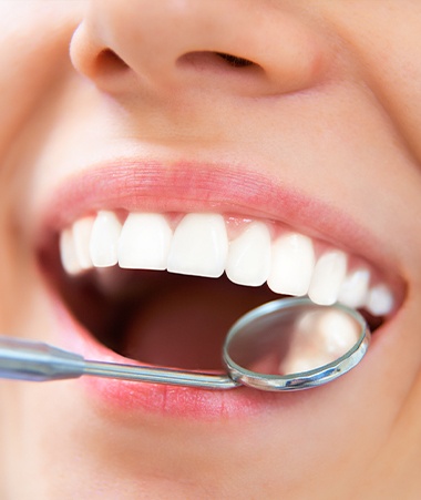 Closeup of healthy smile after tooth colored filling
