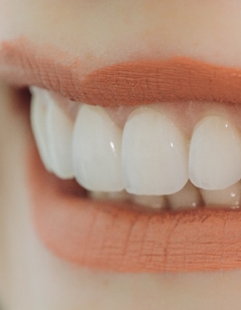 Smile after CEREC dental restoration