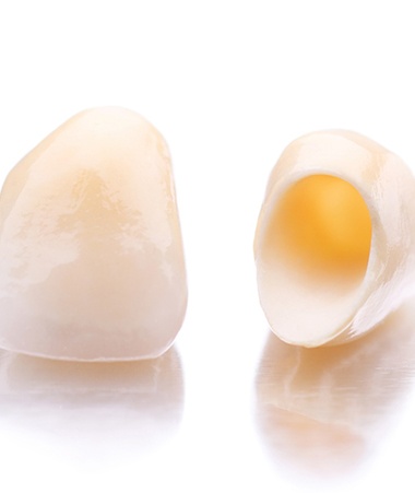 Closeup of dental crowns in Springfield