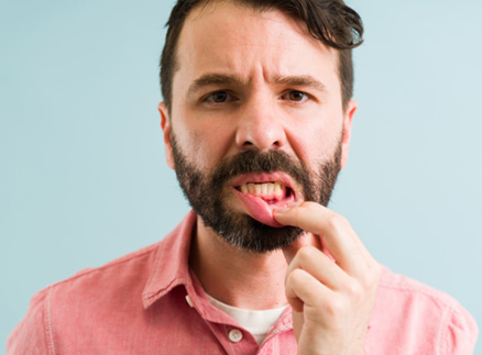 Man pulling down lower lip to reveal dark red gums