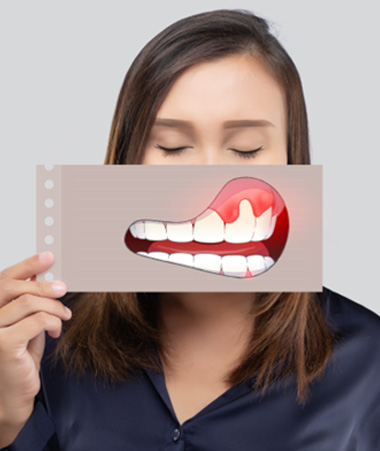 Woman closing eyes holding picture of mouth with gum disease over her face