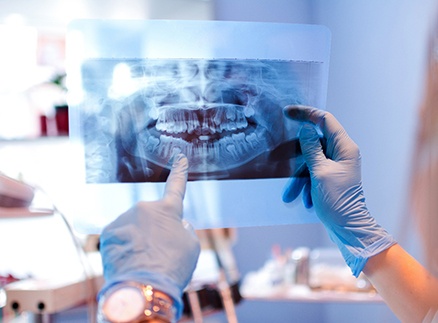 dentist reviewing patient X-ray 