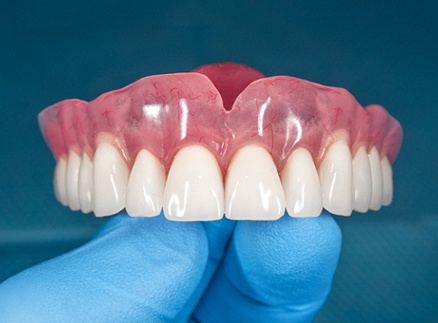 Dentist holding top denture