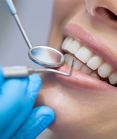 Closeup of smile during scaling and root planing