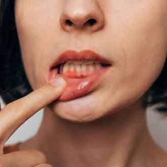 Lady shows inflamed gums