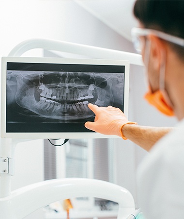 Dental x-rays on computer