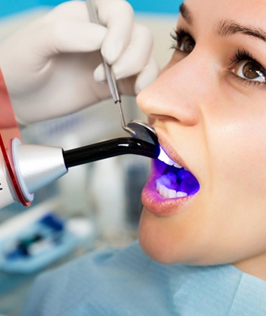 A curing light being used on a patient after porcelain veneer placement