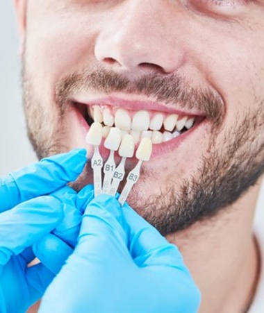 man getting fitted for porcelain veneers in Springfield