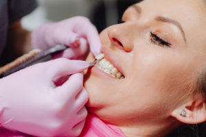 Dentist performing the veneer process on woman