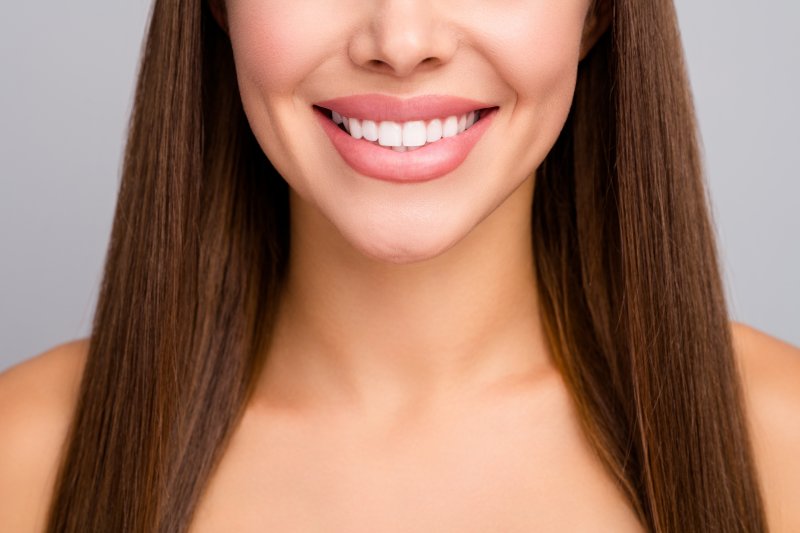 Woman smiling with a mouth full of veneers